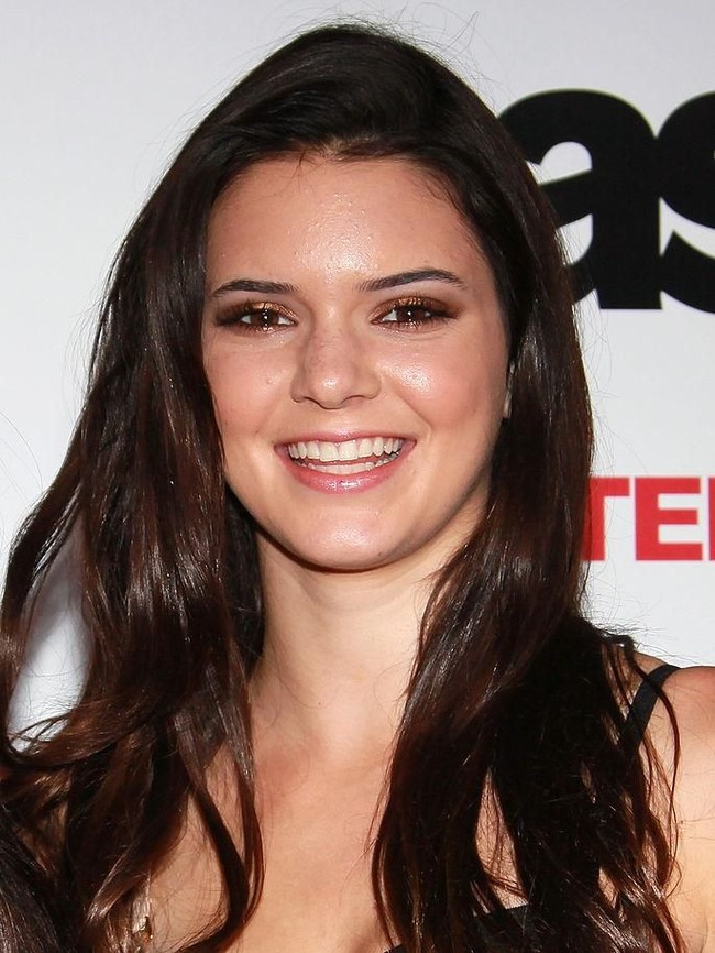 Jerawat parah dialami Kendall Jenner saat masih berusia belasan tahun. Ia pun mengungkapkan pengalamannya yang sempat tidak percaya diri karena jerawat. Usiaku saat itu 13 dan aku pulang ke rumah dengan menangis setiap hari karena orang-orang memandangiku kulitku, tutur mantan kekasih Harry Styles ini. Foto: Getty Images