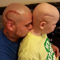 Hati orangtua mana yang tidak luka ketika melihat anaknya jatuh sakit.  Foto ini memperlihatkan seorang ayah dengan tato yang menyerupai bekas luka untuk membangkitkan kepercayaan diri anak yang sedang menderita kanker otak. (Foto: Dok. BrightSide)