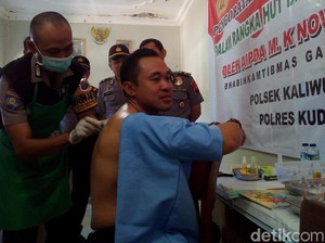 Polisi di Kudus Ini Ahli Bekam, Obati Warga Secara Gratis