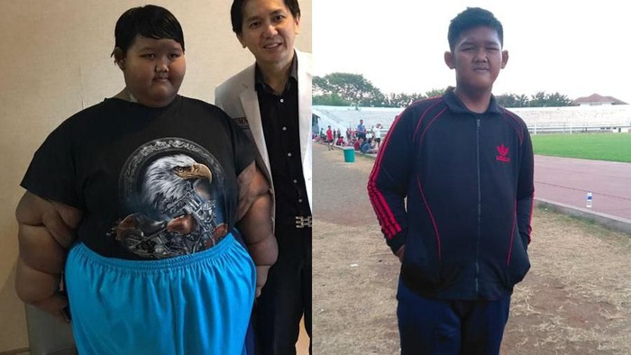 Transformasi Aria, Bocah Tergemuk yang Berhasil Turunkan Muatan 87 Kg Transformasi Aria, Bocah Tergemuk yang Berhasil Turunkan Muatan 87 Kg
