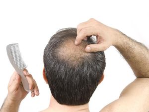 Agar Rambut Tak Cepat Botak Rajinlah Konsumsi 5 Buah Enak Ini