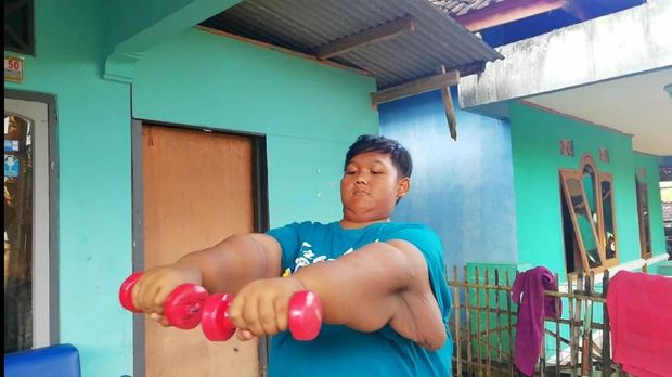 Aria, mantan bocah tergemuk di dunia.