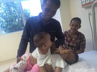Bayi Kembar Siam Adam-Malik Segera Dioperasi Tim Dokter RSUP Medan
