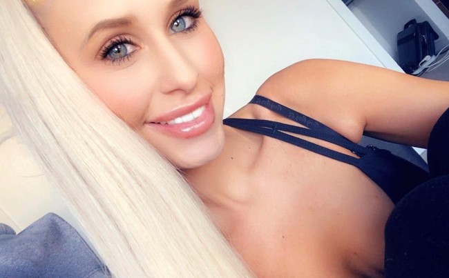 Wanita 26 tahun itu mengaku setiap bangun tidur merasa seperti efek mabuk. Di mana keadaannya menjadi linglung, pusing dan cemas berlebihan. Dia bahkan merasa wajah hingga tubuh bagian kirinya mati rasa.  Foto: dok. Instagram