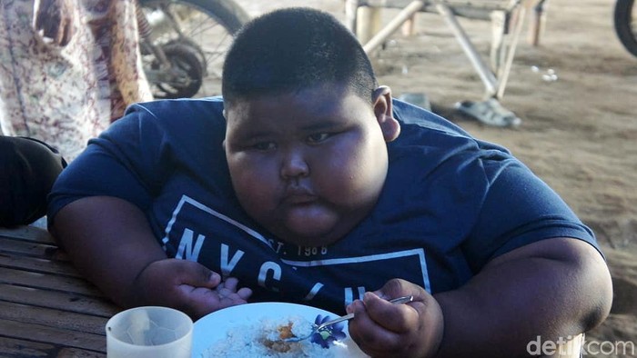 Satia Putra, bocah obesitas asal Karawang yang meninggal karena asma. Foto: Luthfiana