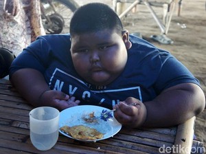 5 Fakta Satia Putra, Bocah Obesitas Ekstrem Asal Karawang yang Meninggal Dunia