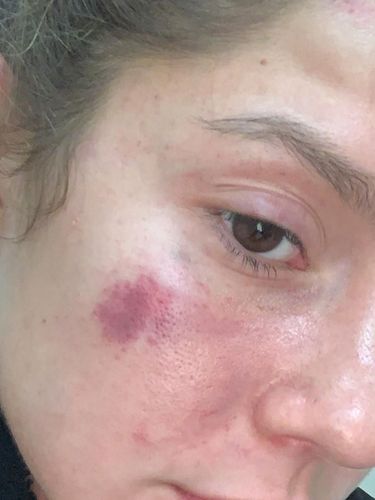 Cerita Model Cantik yang Punya Pacar 'Gila', Dipukuli Hingga Hampir Digantung