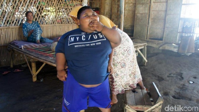 Bocah obesitas asal Kabupaten Karawang meninggal dunia akibat penyakit asma. (Foto: Luthfiana) Bocah obesitas asal Kabupaten Karawang meninggal dunia akibat penyakit asma. (Foto: Luthfiana)