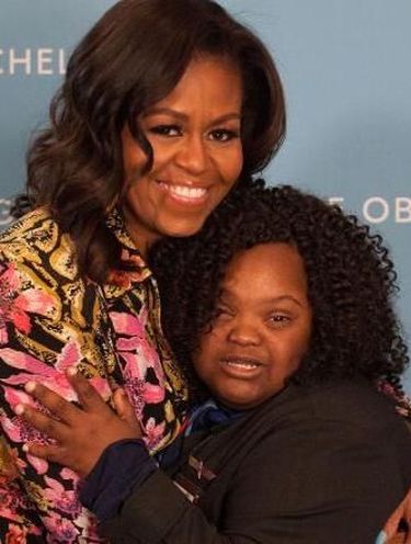 Kisah Remaja Down Syndrome yang Sakit Langka Wujudkan Mimpi Jadi Pramugari