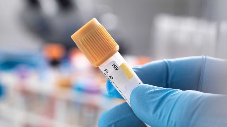 Angka Penularan HIV di Australia Terendah dalam 18 Tahun Angka Penularan HIV di Australia Terendah dalam 18 Tahun