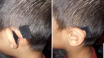 Kalau potongan rambut di belakang telinga kurang rapi, bisa juga dibeginikan. (Foto: Via 9gag)