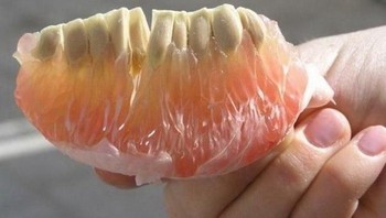 Mirip gigi palsu ya, bisa menebaknya itu apa? Foto: Brightside