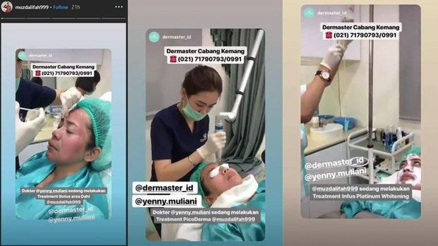 Demi Suami, Muzdalifah Permak Wajah dengan Suntik Botox