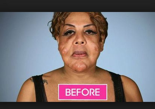 Transgender asal New York itu mengalami penampilan menyeramkan setelah melakukan injeksi kecantikan di 2005. Kala itu Rajee tak tahu menahu bahwa wajahnya telah disuntikkan dengan bahan yang berbahan yakni mengandung semen.  Foto: dok. Instagram, Botched E!