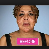 Transgender asal New York itu mengalami penampilan menyeramkan setelah melakukan injeksi kecantikan di 2005. Kala itu Rajee tak tahu menahu bahwa wajahnya telah disuntikkan dengan bahan yang berbahan yakni mengandung semen.  Foto: dok. Instagram, Botched E!