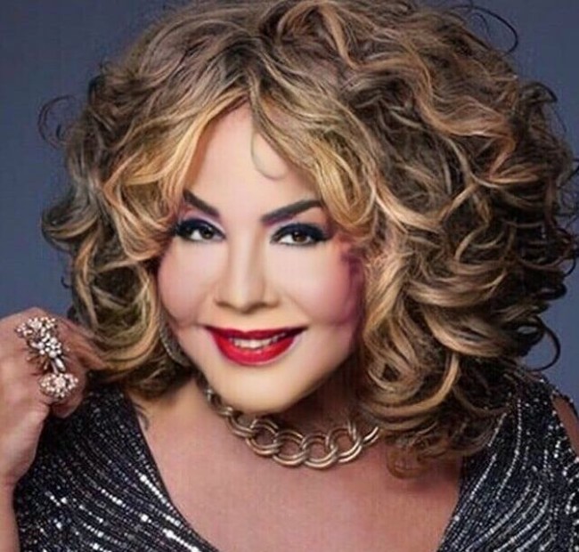 Transgender bernama Rajee Narinesingh menjadi korban suntik filler palsu. Bukannya tampil lebih cantik, ia malah mengalami kerusakan wajah.  Foto: dok. Instagram, Botched E! Foto: dok. Instagram, Botched E!