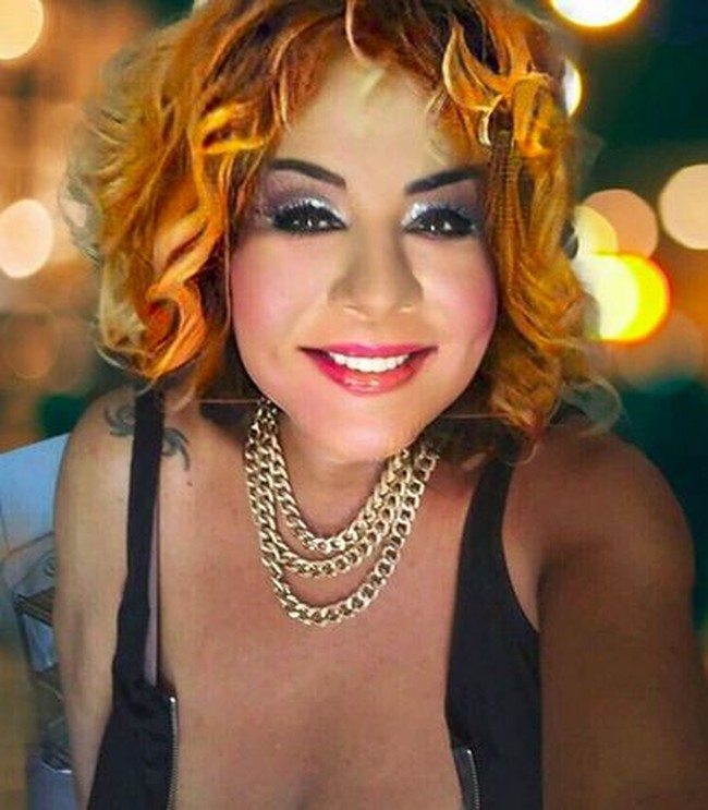 Setelah 14 tahun berlalu dari suntik filler gagalnya itu, wajah aktivis dan seniman itu bisa diselematkan. Wajahnya tak lagi rusak. Foto: dok. Instagram, Botched E!