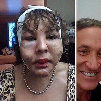 Sampai akhirnya dia mengikuti acara reality show Botched, sebuah acara untuk memperbaiki operasi plastik yang pernah gagal. Sejak 2016, Rajee mendapatkan penanganan intensif dari dua dokter kecantikan Hollywood yang telah populer, Dr. Dubrow dan Dr. Nassif.  Foto: dok. Instagram, Botched E!