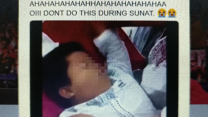 Viral Ekspresi Kocak Anak Pura-pura Pingsan Waktu Disunat