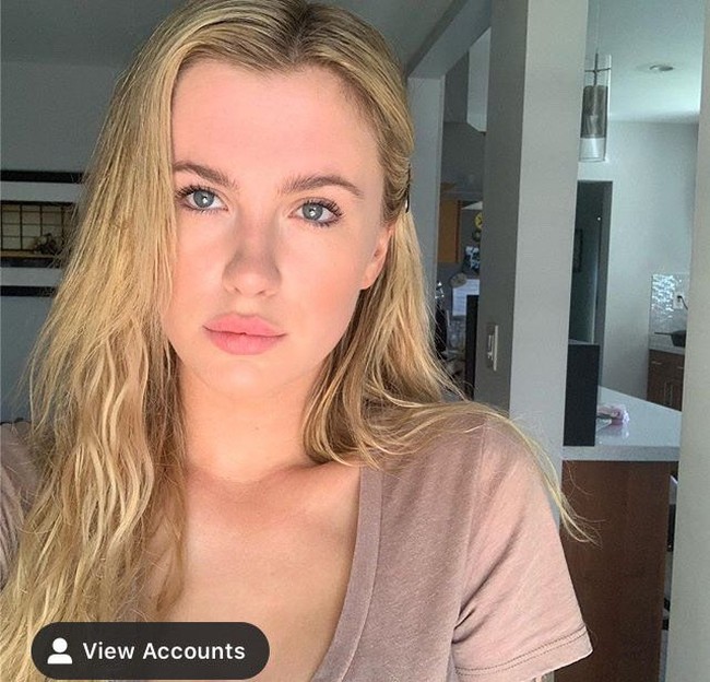 Putri artis Alec Baldwin dan Kim Basinger ini telah berjuang dengan masalah tubuhnya. Dia ingat bagaimana Ireland akan mengonsumsi makanan hanya satu gigitan dan harus lari ke kamar mandi atau minum pil pencernaan. Foto: Instagram @irelandbasingerbaldwin