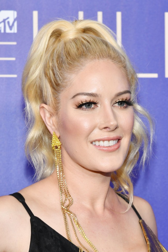 Heidi Montag yang dikenal sebagai bintang reality show baru-baru ini mengungkap alasannya melakukan serangkaian operasi plastik. Tak banyak dalih, ia mengakui jika semua itu dilakukan karena komentar jahat dari para netizen. Foto: Getty Images