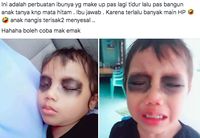 Mata Anak Sakit Karena Main Hp Berbagai Mata