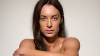 Emily jadi korban kecelakaan pertama di Inggris yang tewas saat mengendarai skuter listrik. Dok. Instagram/emilyhartridge