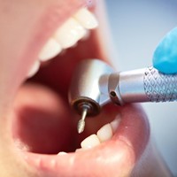 Bor gigi termasuk dalam suara paling mengganggu karena juga menyebabkan rasa ngilu pada telinga. Foto: iStock