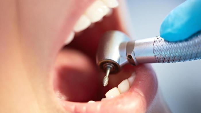 Close-up of human teeth being drilled by dentist
