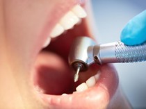 Pria Ini Catat Rekor Pemilik Gigi Terbanyak di Dunia, Totalnya Lebih dari 40