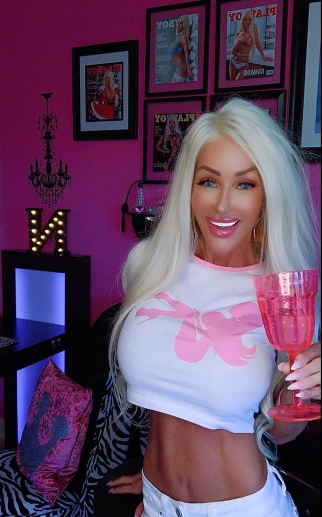 Nannette pertama kali pergi di bawah pisau bedah ketika dia baru berusia 21 tahun. Sejak saat itu ia telah memiliki tiga pekerjaan payudara, pengencangan payudara, filler bibir, Botox dan veneer. Terlepas dari rasa sakit dan banyak biaya untuk semua pekerjaan kosmetik, Nannette mengatakan dia tidak menyesal. Foto: Instagram