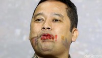  Arief mengungkapkan, kerena masalah lahan tersebut, pihak Kemenkum HAM menganggap Pemkot Tangerang sengaja mempersulit izin pembangungan politeknik karena lahannya akan dibuat persawahan.