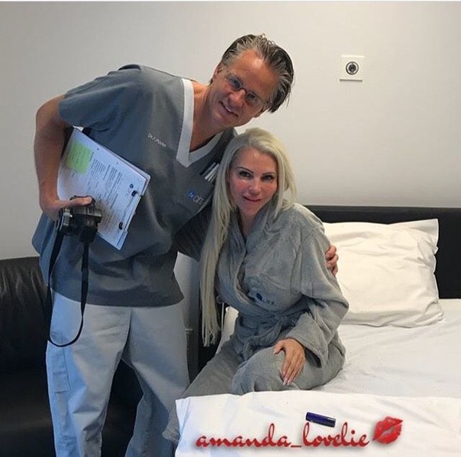 Model asal Skotlandia ini mengalami krisis kepercayaan diri karena menganggap dirinya terlalu kurus. Ia pun memutuskan untuk operasi pembesaran payudara menjadi ukuran 30HH dengan biaya fantastis. Foto: Instagram