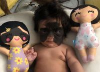 Putri Carol Fenner, Luna memiliki tanda lahir besar di wajahnya 