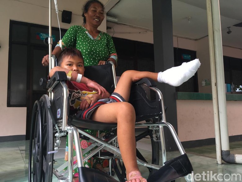 Bocah SD di Mojokerto Alami Luka Bakar Usai Terperosok ke Limbah Abu Bocah SD di Mojokerto Alami Luka Bakar Usai Terperosok ke Limbah Abu