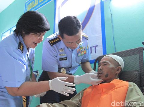 Balita Deby Bahagia Mendapat Kaki Palsu di Hari Bakti TNI AU ke-73