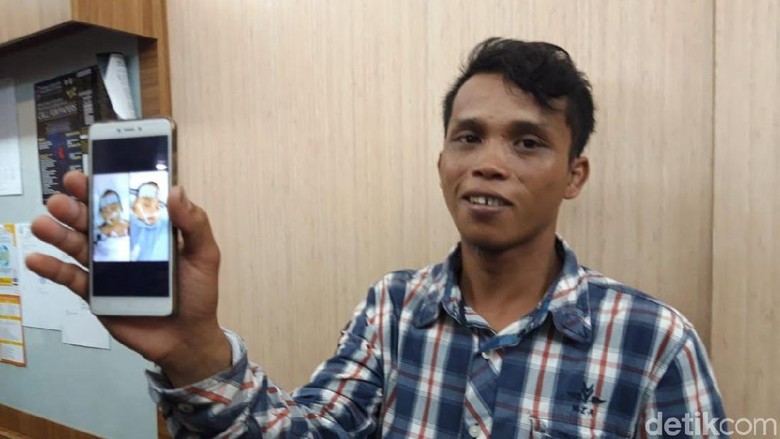 Kembar Siam Adam-Malik Sukses Dipisahkan, Ortu Tak Sabar Bawa ke Kampung Kembar Siam Adam-Malik Sukses Dipisahkan, Ortu Tak Sabar Bawa ke Kampung