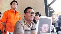 Kriss disebut melakukan pemukulan pada Anthony. Lamhot Aritonang/detikFoto