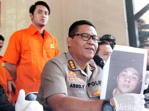 Polisi tunjukkan foto korban pemukulan