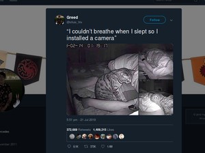 Pria Ini Kesulitan Bernapas Tiap Tidur, Ternyata Penyebabnya Mengejutkan