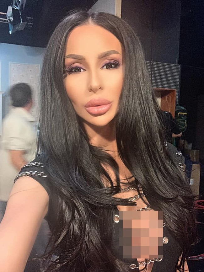 Wanita berusia 30 tahun ini pun dituduh mengambil operasi plastik terlalu jauh hingga menyebabkan penampilannya rusak. Foto: Facebook