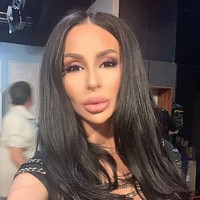 Wanita berusia 30 tahun ini pun dituduh mengambil operasi plastik terlalu jauh hingga menyebabkan penampilannya rusak. Foto: Facebook