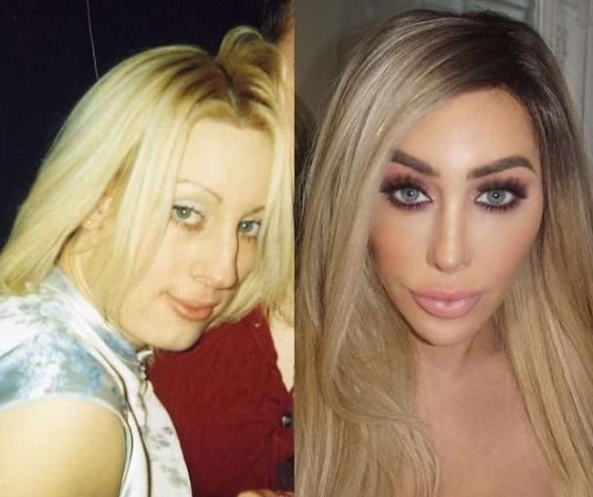 Inilah penampilan sebelum dan sesudah Laura melakukan operasi plastik. Selama 17 tahun ini, setiap tahunnya ada saja bagian tubuh Laura yang diubah lewat pisau bedah. Foto: dok. Instagram