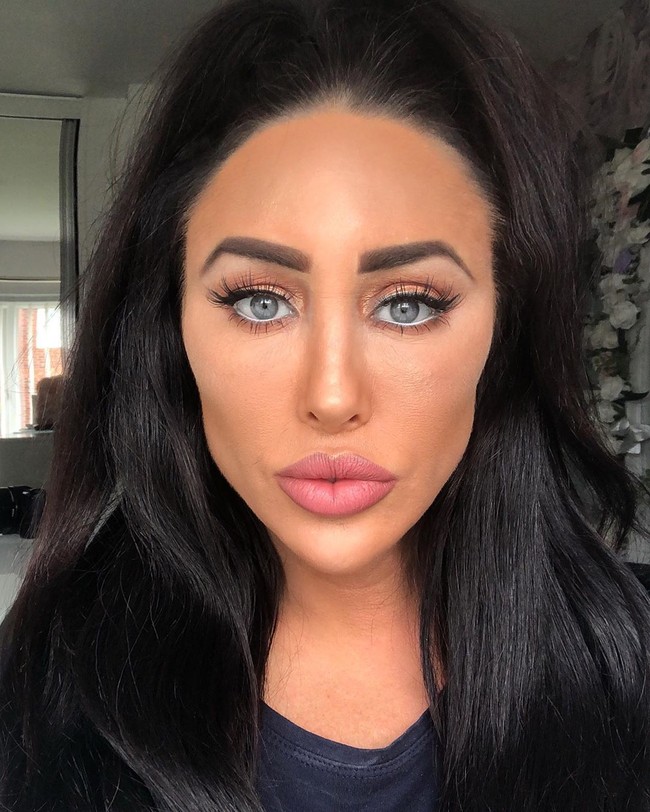 Tak hanya payudara dan bokongnya saja yang palsu. Bagian wajahnya pun sudah terlihat tidak asli lagi. Selain operasi hidung, tampak ia melakukan suntik filler dan botox di area wajahnya sehingga penampilan wajahnya tampak kaku.  Foto: dok. Instagram