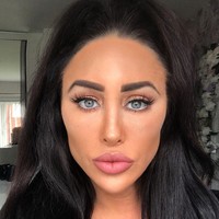 Tak hanya payudara dan bokongnya saja yang palsu. Bagian wajahnya pun sudah terlihat tidak asli lagi. Selain operasi hidung, tampak ia melakukan suntik filler dan botox di area wajahnya sehingga penampilan wajahnya tampak kaku.  Foto: dok. Instagram