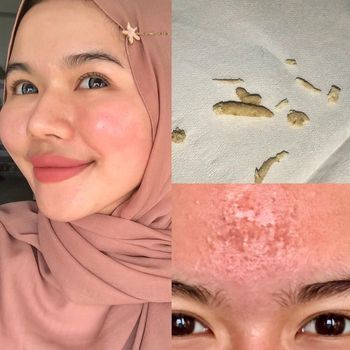 Selebgram hijab merilis tutorial membuat peeling di rumah dengan harga murah, tapi bikin wajah glowing.