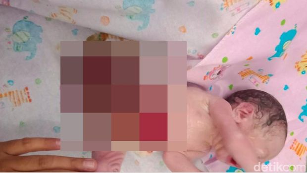 Setelah menjalani perawatan intensif, bayi Arjun akhirnya meninggal dunia.