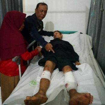 Bergulat Lawan Babi Hutan, Jaja Terkapar Bersimbah Darah