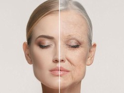 Efek Polusi Pada Kecantikan