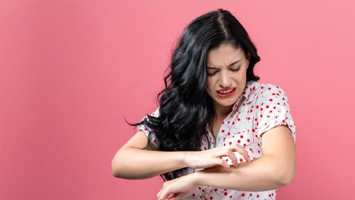 Prurigo atau darah manis sangat sensitif terhadap gigitan serangga. (Foto ilustrasi: iStock) Prurigo atau darah manis sangat sensitif terhadap gigitan serangga. (Foto ilustrasi: iStock)